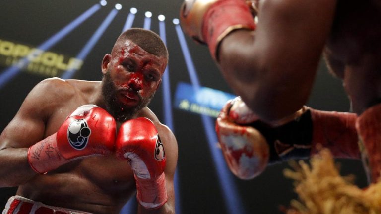 GRAPHIC VIDEO: Boxer shows off 25 stitches after suffering a nasty cut in a fight