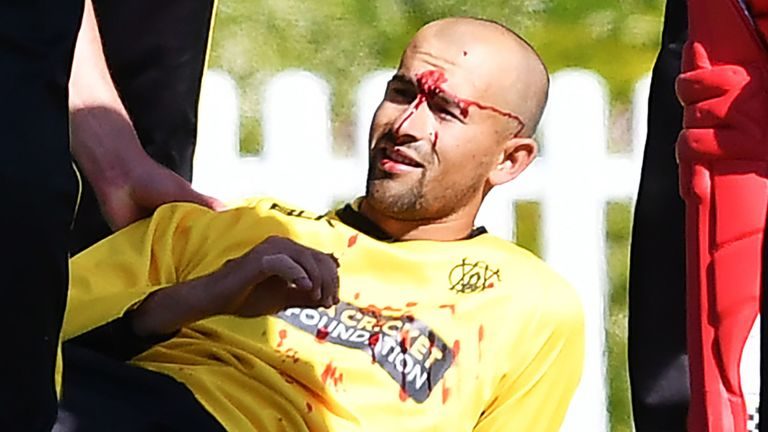 Watch: Aussie cricketer Ashton Agar suffers horrible laceration on nose after getting his by his brother during a match (Graphic)